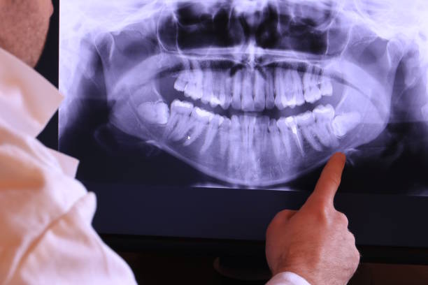 Best Broken or Chipped Tooth Repair in Inverness, CO